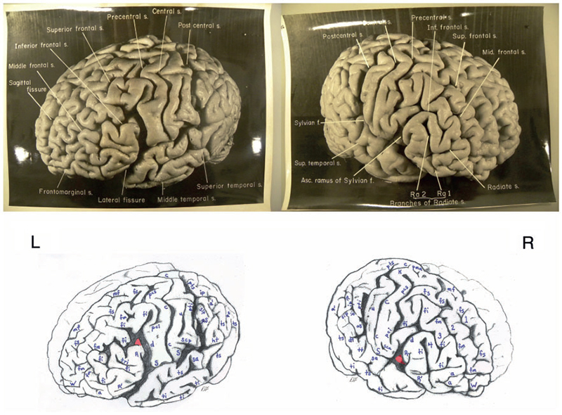 albert einstein brain vs normal brain